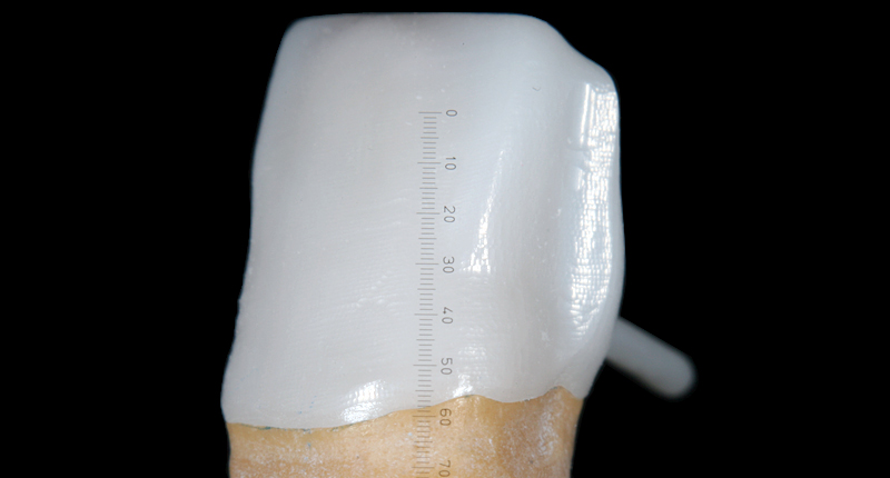 自費治療では主にどのような素材で歯冠を作製するのですか？
